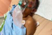 Pelaku perampokan menjalani perawatan intensif di Rumah Sakit BP Batam. Matapedia6.com/ Dok Polsek