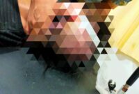 Kepala korban kecelakaan di wahana Gokart Golden Prawn yang merupakan warga negara Singapura atas nama Arini Binte Mohamed, memerah karena rambutnya tercabut setelah terlilit as roda gokart, Rabu (21/2/2024). Matapedia6.com/ Istimewa