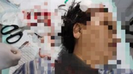 Korban saat mendapat perawatan di rumah sakit Selasa (24/9/2024). Matapedia6.com/ Istimewa