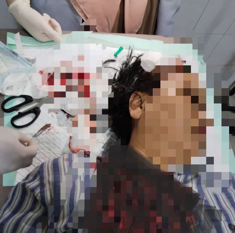 Korban saat mendapat perawatan di rumah sakit Selasa (24/9/2024). Matapedia6.com/ Istimewa