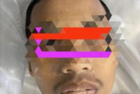 Mayat laki-laki yang sebelumnya di temukan di danau Purna Yudha Indah, Nongsa Kota Batam, Provinsi Kepri, Sabtu (11/1/2025) lalu. Matapedia6.com/Istimewa